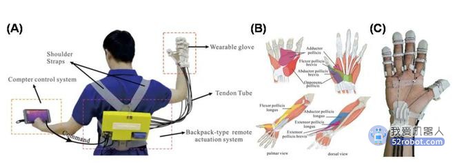 柔性外骨骼机器人研究取得新进展，具有完全拇指运动功能